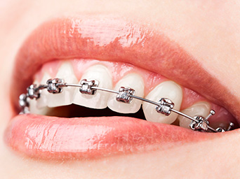 mejor tratamiento ortodoncia Granada